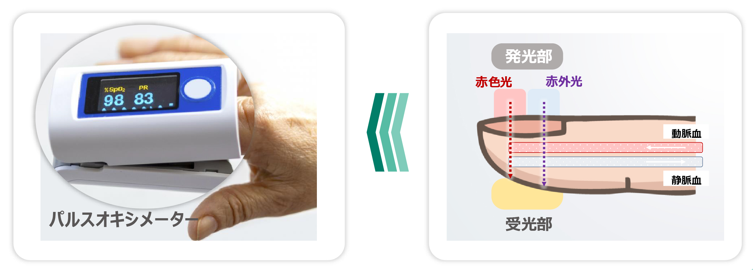 古くて新しい技術「PPG」